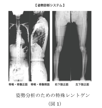 姿勢分析のための特殊レントゲン