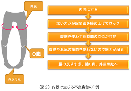 （図２）内股で生じる不良姿勢の１例